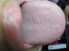 Anything on my Tongue?